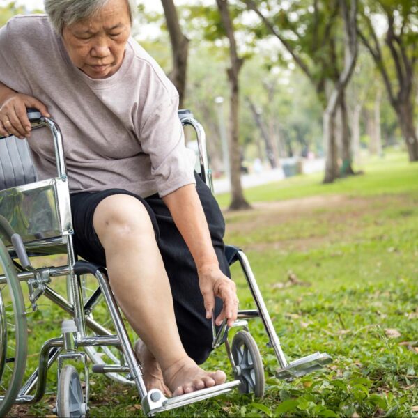 โรคปลอกประสาทเสื่อมแข็ง (Multiple Sclerosis) คืออะไร รักษาอย่างไร?